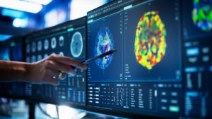 AI Impact on Cancer Detection