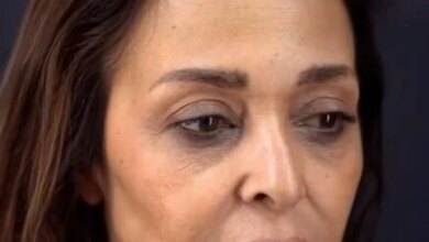 داليا البحيري حديث السوشيال ميديا بعد تغيير ملامحها.. والفنانة تكشف التفاصيل 6 داليا البحيري وتجميل الوجه