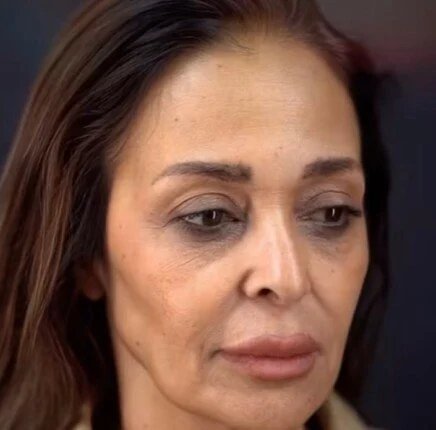 داليا البحيري وتجميل الوجه