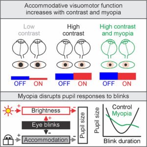 قصر-النظر-الاضاءة-الداخلية