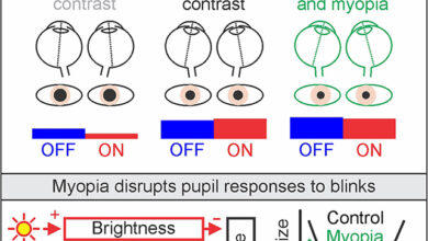 قصر-النظر-الاضاءة-الداخلية