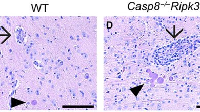 خلايا-الدماغ-تنتحر-لمواجهة-التوكسوبلازما