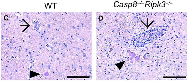 خلايا-الدماغ-تنتحر-لمواجهة-التوكسوبلازما