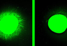 علاج إصابات الحبل الشوكي