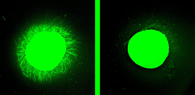 علاج إصابات الحبل الشوكي