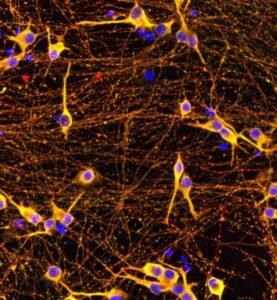 الزهايمر-خلايا-الدماغ-مقاومة-تاو