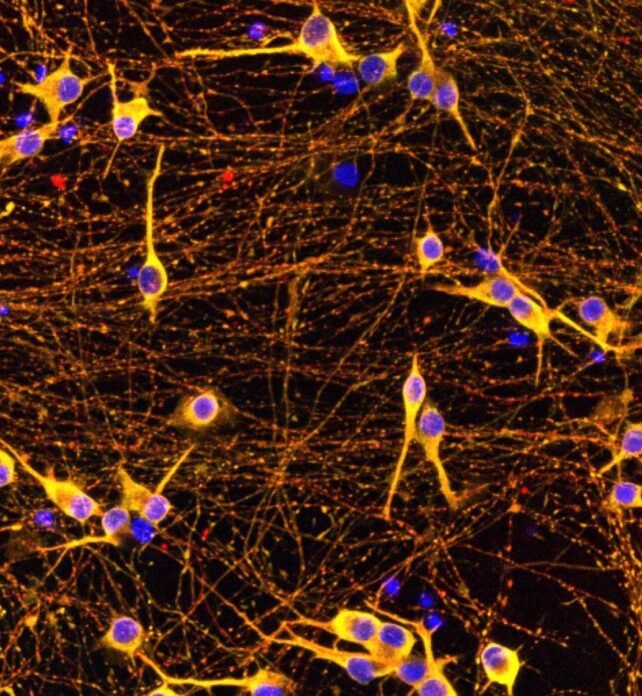 الزهايمر-خلايا-الدماغ-مقاومة-تاو