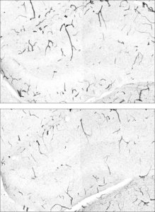 الرياضة-الزهايمر