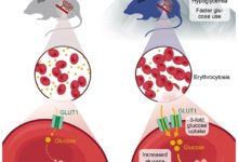 السكري-مرتفعات-علاج