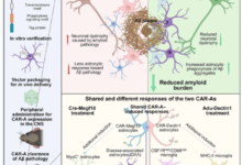علاج-الزهايمر-الجيني-الجديد