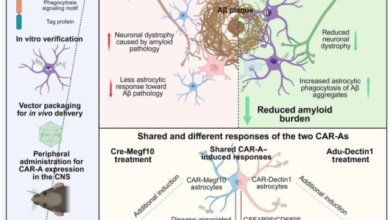 علاج-الزهايمر-الجيني-الجديد