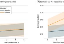 الزهايمر-النساء-بروتين-باركنيسون