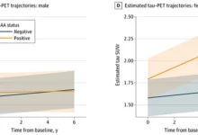 الزهايمر-النساء-بروتين-باركنيسون