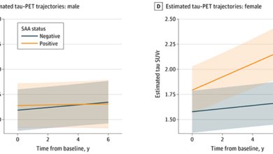 الزهايمر-النساء-بروتين-باركنيسون