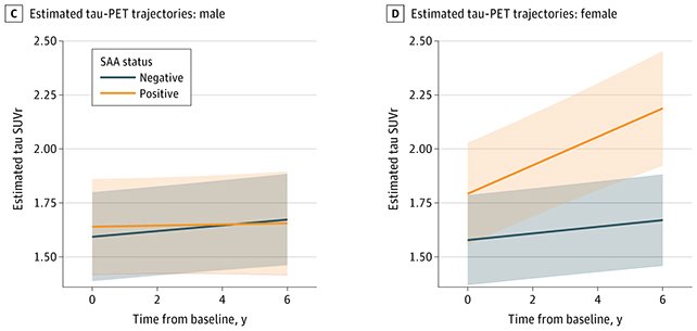 الزهايمر-النساء-بروتين-باركنيسون