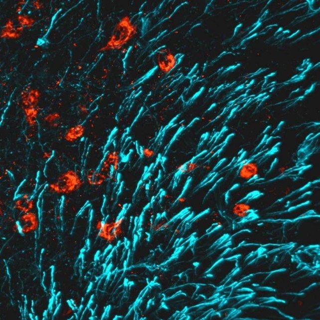 New Breakthrough to Strengthen Bone Could Reverse Osteoporosis