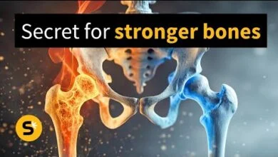 علاج_هشاشة_العظام_تقوية_العظام