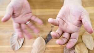 باركنسون-دراسة-أستراليا