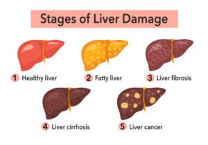 القنب-الكبد-الدهني-علاج-واعد