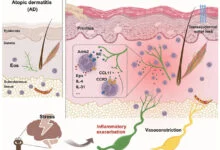 stress-eczema-nerve-pathway
