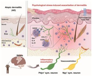 stress-eczema-nerve-pathway