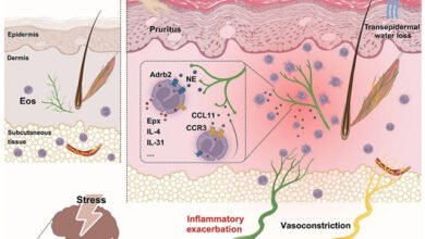 stress-eczema-nerve-pathway