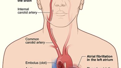 جيل-مغناطيسي-يمنع-السكتات