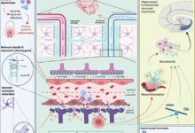 سباكة الدماغ والذهان