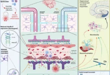 سباكة الدماغ والذهان