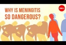 تداعيات-الحمى-الشوكية-على-الناجين