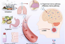بلاستيك-الشلل-الرعاش