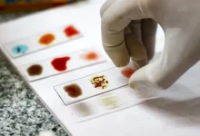 فصيلة الدم B والسكري