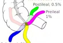 الزائدة-الدودية-تطور-ووظائف