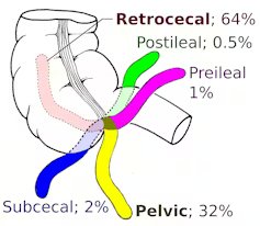 الزائدة-الدودية-تطور-ووظائف