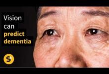 1775090664 Your Vision Can Predict Dementia 12 Years Before a Diagnosis