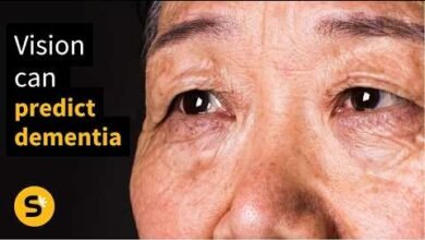 1775090664 Your Vision Can Predict Dementia 12 Years Before a Diagnosis
