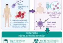 علاج CAR-T للمناعة الذاتية