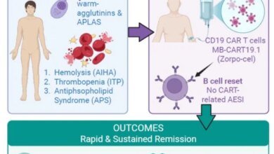 علاج CAR-T للمناعة الذاتية
