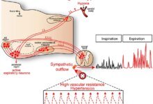 لغز ضغط الدم والدماغ