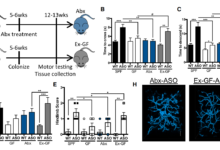 تلاعب في أبحاث باركنسون
