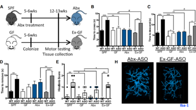 تلاعب في أبحاث باركنسون