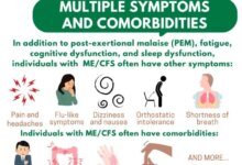 ضحايا التعب المزمن