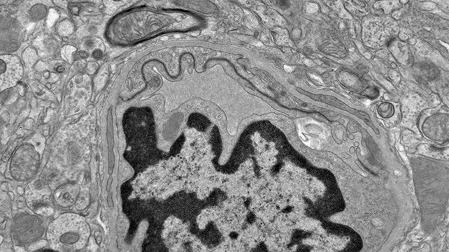 تأثير زيت السمك على الدماغ