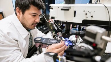 تأثير APOE4 على الدماغ