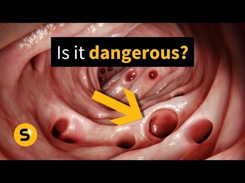 تشريح الرتوج المعوية