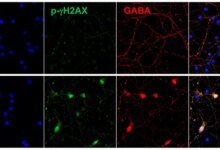 This Gene Is Linked to Lower Alzheimers Risk – And