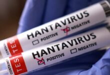 hantavirus reu 2459423