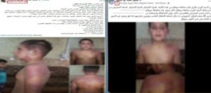 نفي تعذيب طفل بسوهاج