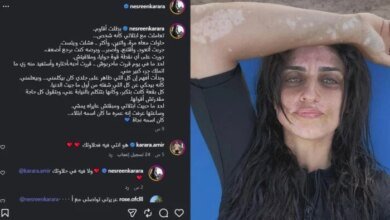 نسرين كرارة والبهاق