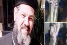 غموض يلف واقعة عين شمس.. هل يحسم تفريغ كاميرات المراقبة حقيقة الاعتداء على كاهن مدينة السلام؟ 2 واقعة كاهن عين شمس